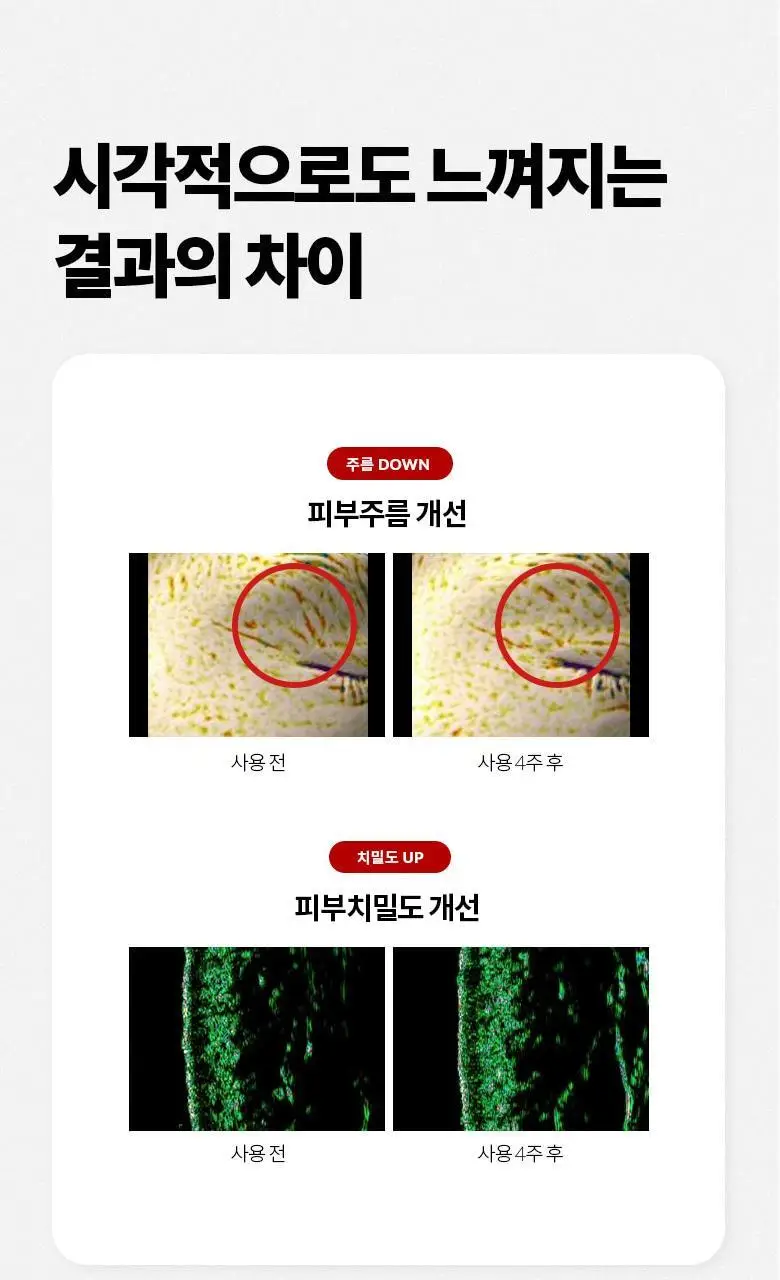 [단독기획/레티날0.1%] 닥터디퍼런트 비타리프트 에이 포르테 2입 기획 상세페이지 29